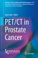 ar gene in prostate cancer,Understanding the AR Gene in Prostate Cancer